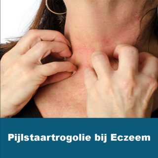 Pijlstaartrogolie Eczeem